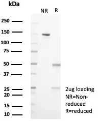 SDS-PAGE Analysis of Purified IL18R1 Mouse Monoclonal Antibody (IL18R1/7591). Confirmation of Purity and Integrity of Antibody.