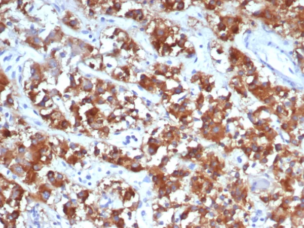 Formalin-fixed, paraffin-embedded human adrenal gland stained with IL18R1 Mouse Monoclonal Antibody (IL18R1/7591). HIER: Tris/EDTA, pH9.0, 45min. 2°C: HRP-polymer, 30min. DAB, 5min.