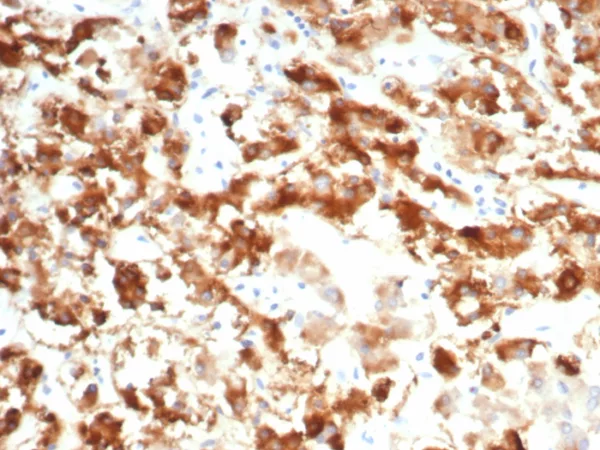 Formalin-fixed, paraffin-embedded human adrenal gland stained with IL18R1 Mouse Monoclonal Antibody (IL18R1/7592). HIER: Tris/EDTA, pH9.0, 45min. 2°C: HRP-polymer, 30min. DAB, 5min.