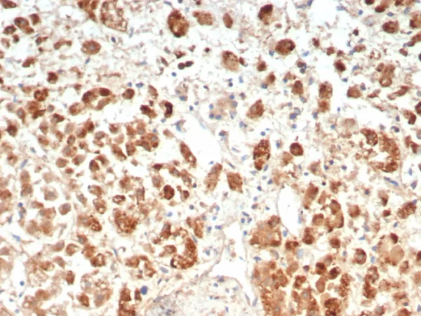 Formalin-fixed, paraffin-embedded human adrenal gland stained with IL18R1 Mouse Monoclonal Antibody (IL18R1/7593). HIER: Tris/EDTA, pH9.0, 45min. 2°C: HRP-polymer, 30min. DAB, 5min.