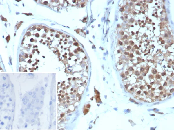 Formalin-fixed, paraffin-embedded human testis stained with Cyclin B1 Rabbit Recombinant Monoclonal Antibody (CCNB1/9242R). Inset: PBS instead of primary antibody; secondary only negative control.