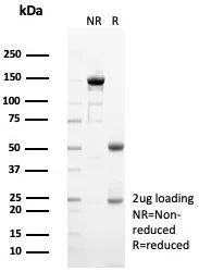 SDS-PAGE Analysis of Purified SIGLEC10 Mouse Monoclonal Antibody (SIGLEC10/7582). Confirmation of Purity and Integrity of Antibody.