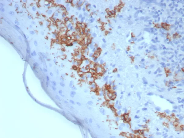 Formalin-fixed, paraffin-embedded human skin stained with  CD1a Mouse Recombinant Monoclonal Antibody (rC1A/8110). HIER: Tris/EDTA, pH9.0, 45min. 2: HRP-polymer, 30min. DAB, 5min.