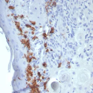 Formalin-fixed, paraffin-embedded human skin stained with  CD1a Mouse Recombinant Monoclonal Antibody (C1A/8111R). HIER: Tris/EDTA, pH9.0, 45min. 2: HRP-polymer, 30min. DAB, 5min.