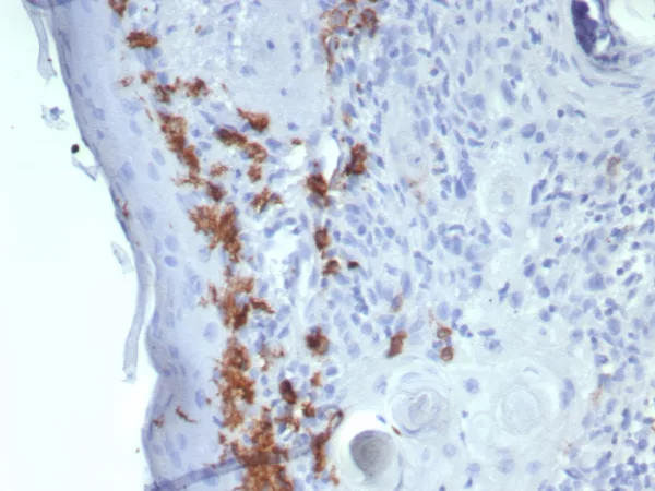 Recombinant CD1a / HTA1 (Mature Langerhans Cells Marker) Antibody