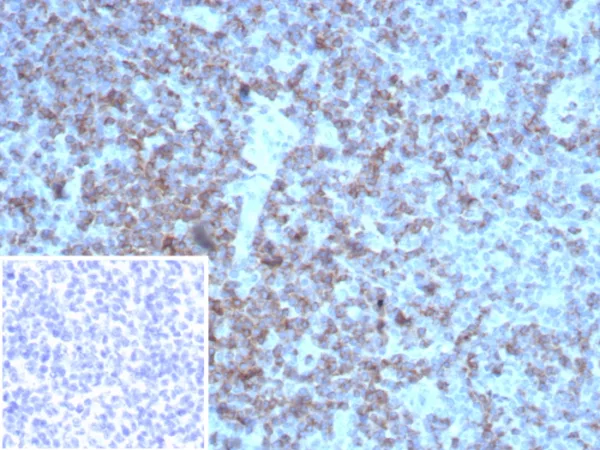 Recombinant CD2 / Lymphocyte Function Antigen 2 (LFA-2) Antibody - Image 2