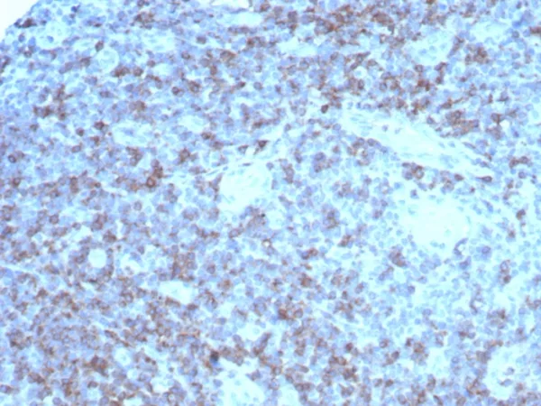 Recombinant CD2 / Lymphocyte Function Antigen 2 (LFA-2) Antibody - Image 3