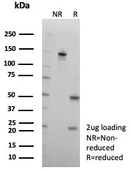 SDS-PAGE Analysis of Purified CD2 Recombinant Rabbit Monoclonal Antibody (LFA2/8681R). Confirmation of Purity and Integrity of Antibody.