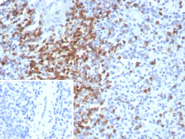 Recombinant CD2 / Lymphocyte Function Antigen 2 (LFA-2) Antibody - Image 2