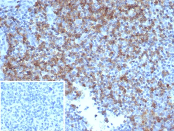 Formalin-fixed, paraffin-embedded human tonsil stained with CD6 Recombinant Mouse Monoclonal Antibody (rC6/372). Inset: PBS instead of primary antibody; secondary only negative control.