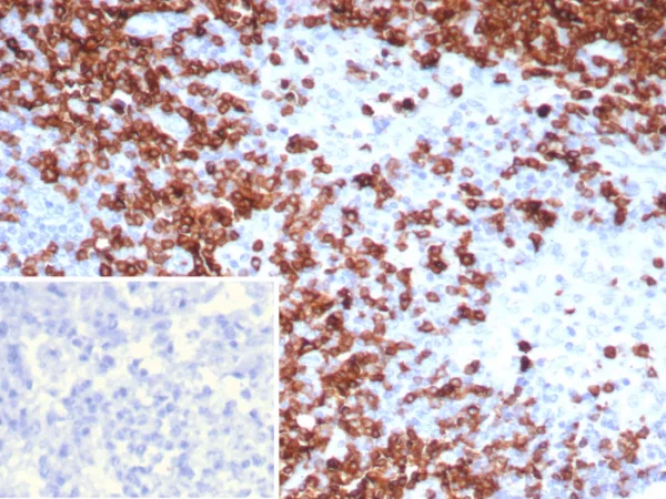 Formalin-fixed, paraffin-embedded human lymph node stained with CD7 Mouse Monoclonal Antibody (CD7/7605). Inset: PBS instead of primary antibody; secondary only negative control.