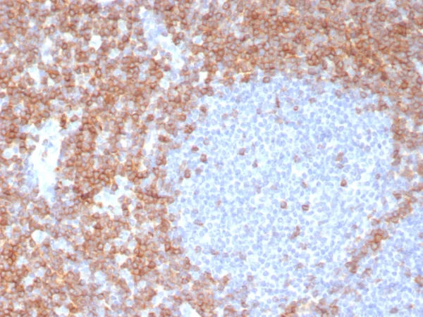 Formalin-fixed, paraffin-embedded human tonsil stained with CD7 Recombinant Rabbit Monoclonal Antibody (CD7/8118R). HIER: Tris/EDTA, pH9.0, 45min. 2: HRP-polymer, 30min. DAB, 5min.