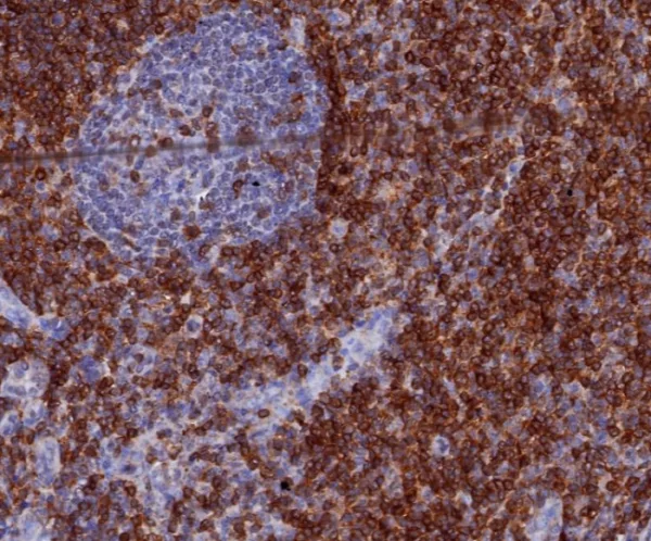 Formalin-fixed, paraffin-embedded human tonsil stained with CD7 Recombinant Rabbit Monoclonal Antibody (CD7/3868R). HIER: Tris/EDTA, pH9.0, 45min. 2°C: HRP-polymer, 30min. DAB, 5min.