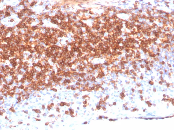 Formalin-fixed, paraffin-embedded human lymph node stained with CD7 Recombinant Rabbit Monoclonal Antibody (CD7/3868R).