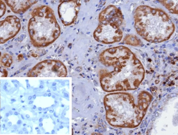 Formalin-fixed, paraffin-embedded human kidney stained with CD7 Recombinant Rabbit Monoclonal Antibody (CD7/3868R). Inset: PBS instead of primary antibody; secondary only negative control.