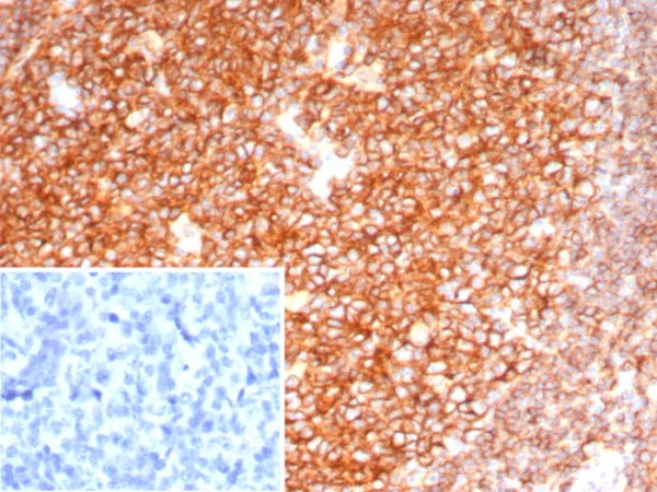 Formalin-fixed, paraffin-embedded human Tonsil stained with CD19 Mouse Monoclonal Antibody (CD19/7665). Inset: PBS instead of primary antibody; secondary only negative control. 