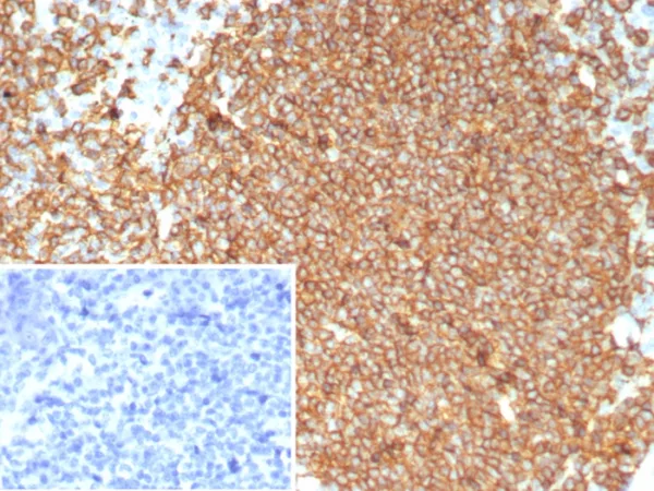 Recombinant CD20 / MS4A1 (B-Cell Marker) Antibody - Image 3