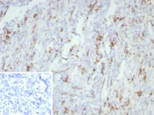 Formalin-fixed, paraffin-embedded human tonsil stained with CD163 Recombinant Mouse Monoclonal Antibody (rM130/8823). Inset: PBS instead of primary antibody; secondary only negative control.