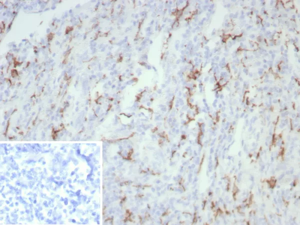 Formalin-fixed, paraffin-embedded human tonsil stained with CD163 Recombinant Mouse Monoclonal Antibody (rM130/8823). Inset: PBS instead of primary antibody; secondary only negative control.