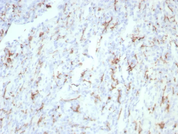 Formalin-fixed, paraffin-embedded human tonsil stained with CD163 Recombinant Mouse Monoclonal Antibody (rM130/8823). HIER: Tris/EDTA, pH9.0, 45min. 2°C: HRP-polymer, 30min. DAB, 5min.