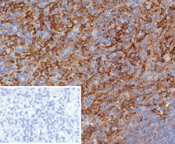 Formalin-fixed, paraffin-embedded human spleen stained with CD163 Recombinant Rabbit Monoclonal Antibody (M130/8361R). HIER: Tris/EDTA, pH9.0, 45min. 2: HRP-polymer, 30min. DAB, 5min.