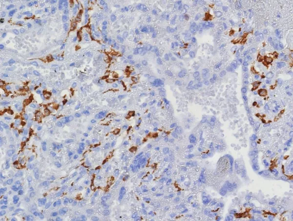 Formalin-fixed, paraffin-embedded human placenta stained with CD163 Recombinant Rabbit Monoclonal Antibody (M130/8361R). HIER: Tris/EDTA, pH9.0, 45min. 2: HRP-polymer, 30min. DAB, 5min.