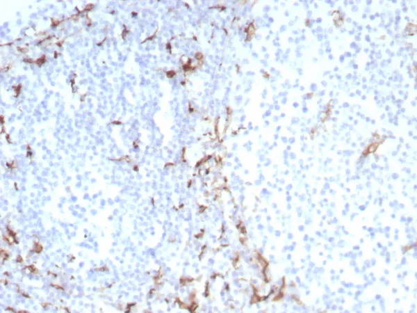 Formalin-fixed, paraffin-embedded human tonsil stained with CD163 Recombinant Rabbit Monoclonal Antibody (M130/8822R). HIER: Tris/EDTA, pH9.0, 45min. 2°C: HRP-polymer, 30min. DAB, 5min.