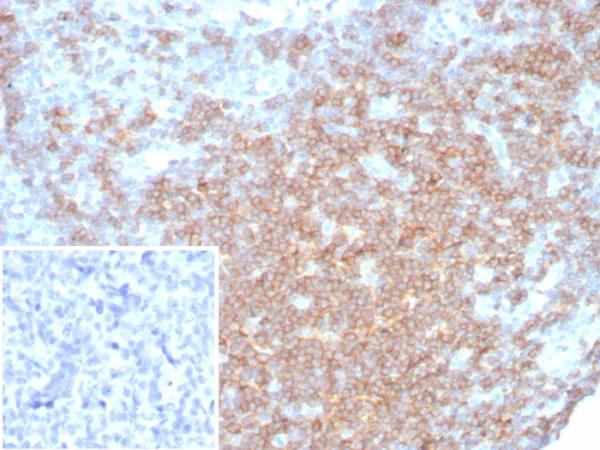 Recombinant CD27 (Tumor Necrosis Factor Receptor Superfamily 7) Antibody