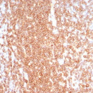 Formalin-fixed, paraffin-embedded human lymph node stained with CD27 Rabbit Recombinant Monoclonal Antibody (LPFS2/8574R). HIER: Tris/EDTA, pH9.0, 45min. 2°C: HRP-polymer, 30min. DAB, 5min.