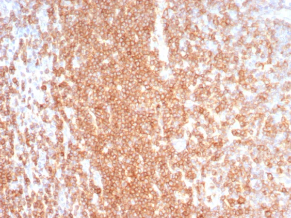 Formalin-fixed, paraffin-embedded human lymph node stained with CD27 Rabbit Recombinant Monoclonal Antibody (LPFS2/8574R). HIER: Tris/EDTA, pH9.0, 45min. 2°C: HRP-polymer, 30min. DAB, 5min.