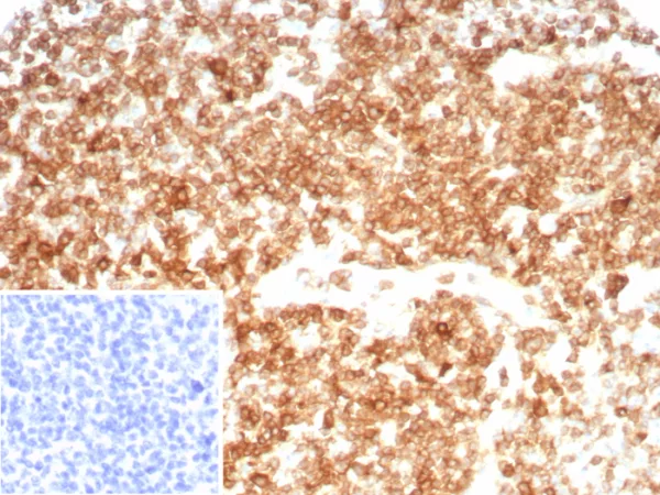 Formalin-fixed, paraffin-embedded human tonsil stained with CD27 Rabbit Recombinant Monoclonal Antibody (LPFS2/8607R). Inset: PBS instead of primary antibody; secondary only negative control.