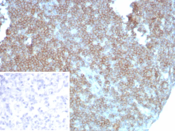 Recombinant CD27 (Tumor Necrosis Factor Receptor Superfamily 7) Antibody