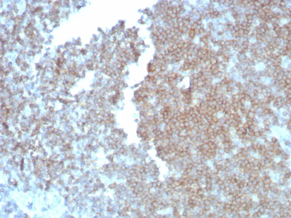 Recombinant CD27 (Tumor Necrosis Factor Receptor Superfamily 7) Antibody - Image 2