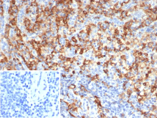 CD33 Antibody in Immunohistochemistry (IHC (P))