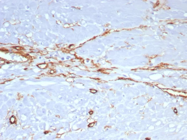 Formalin-fixed, paraffin-embedded human uterus stained with  CD34 Recombinant Mouse Monoclonal Antibody (rHPCA1/8573). HIER: Tris/EDTA, pH9.0, 45min. 2°C: HRP-polymer, 30min. DAB, 5min.