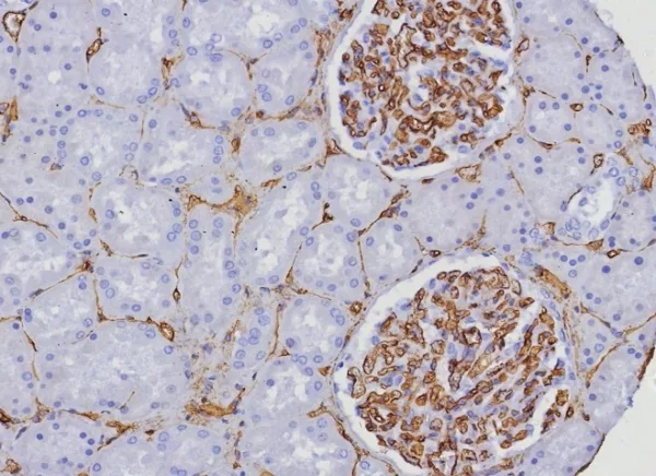 Formalin-fixed, paraffin-embedded human kidney stained with CD34 Rabbit Recombinant Monoclonal Antibody (HPCA1/8333R). HIER: Tris/EDTA, pH9.0, 45min. 2°C: HRP-polymer, 30min. DAB, 5min.