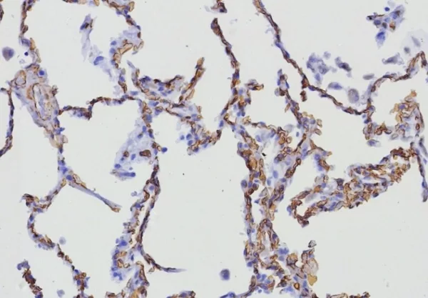 Formalin-fixed, paraffin-embedded human lung stained with CD34 Rabbit Recombinant Monoclonal Antibody (HPCA1/8333R). HIER: Tris/EDTA, pH9.0, 45min. 2°C: HRP-polymer, 30min. DAB, 5min.