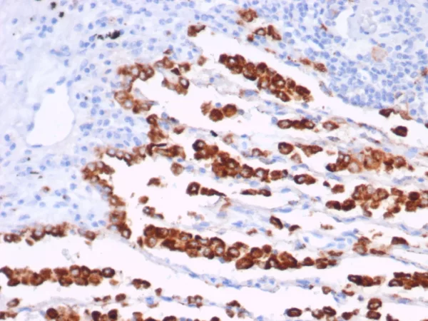 Recombinant Napsin A (Lung Adenocarcinoma Marker) Antibody