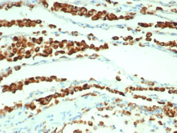 Recombinant Napsin A (Lung Adenocarcinoma Marker) Antibody - Image 2