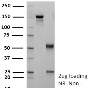 SDS-PAGE Analysis of Purified CD36 Recombinant Mouse Monoclonal Antibody (rGPIIIb/9240). Confirmation of Purity and Integrity of Antibody.