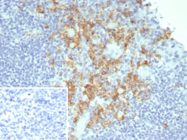 Formalin-fixed, paraffin-embedded human tonsil stained with CD38 Recombinant Mouse Monoclonal Antibody (rCD38/8045). Inset: PBS instead of primary antibody; secondary only negative control.