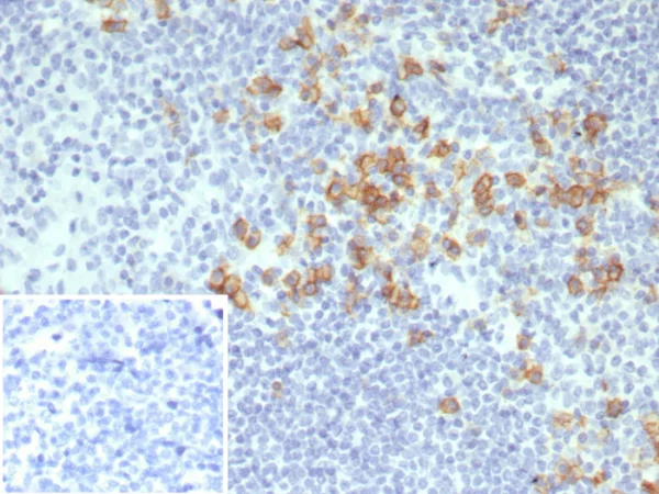 Recombinant CD38 (ADP Ribosyl Cyclase I) Antibody