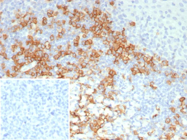 Recombinant CD38 (ADP Ribosyl Cyclase I) Antibody