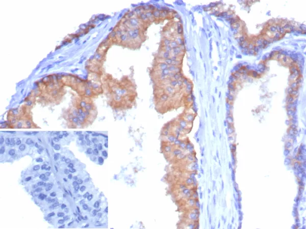 Formalin-fixed, paraffin-embedded human tonsil stained with CD38 Recombinant Rabbit Monoclonal Antibody (CD38/8335R). Inset: PBS instead of primary antibody; secondary only negative control.