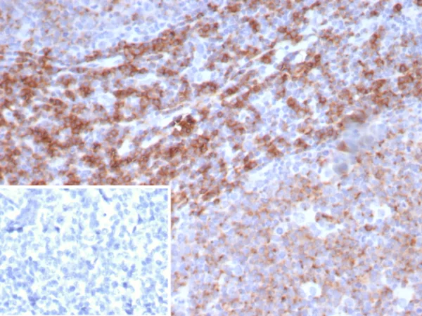 Recombinant CD39 Antibody