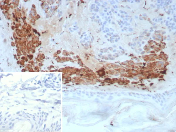 KLK4 / Kallikrein related peptidase 4 Antibody