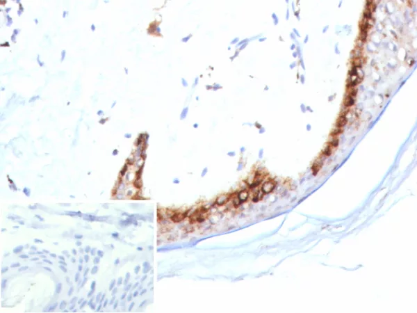 KLK4 / Kallikrein related peptidase 4 Antibody