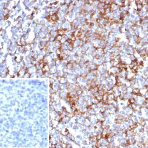 Formalin-fixed, paraffin-embedded human tonsil stained with CD63 Recombinant Mouse Monoclonal Antibody (rLAMP3/8604). Inset: PBS instead of primary antibody; secondary only negative control.