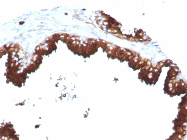 Formalin-fixed, paraffin-embedded human prostate stained with CD63 Recombinant Rabbit Monoclonal Antibody (LAMP3/8770R). HIER: Tris/EDTA, pH9.0, 45min. 2°C: HRP-polymer, 30min. DAB, 5min.