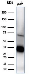 Western blot analysis of Raji cell lysate using CD74 Mouse Monoclonal Antibody (CLIP/7194).